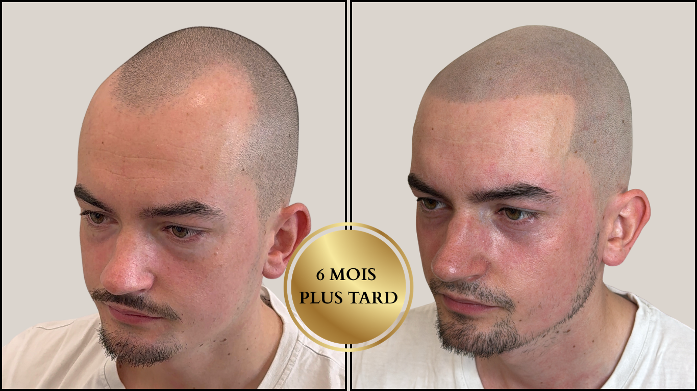 « On me demande souvent pourquoi je ne laisse pas pousser mes cheveux. »