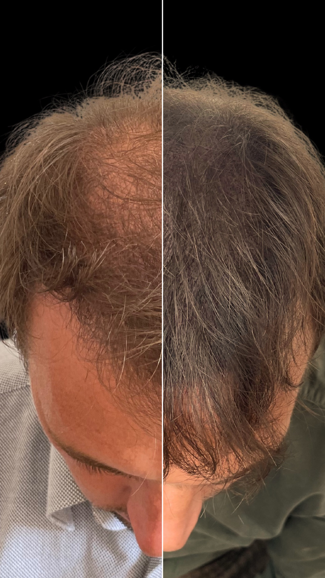 A84FD2B3-2204-48D9-81B1-33DC57B90517