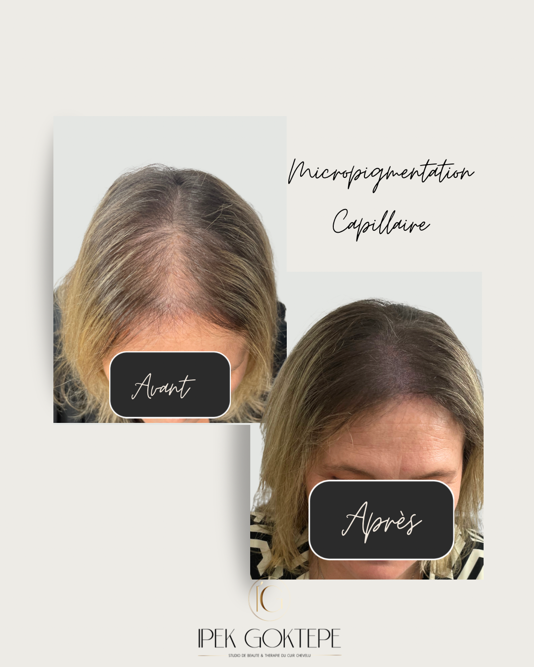 Beige Minimalist Skincare Before and After Instagram Post (1080 x 1350 px)