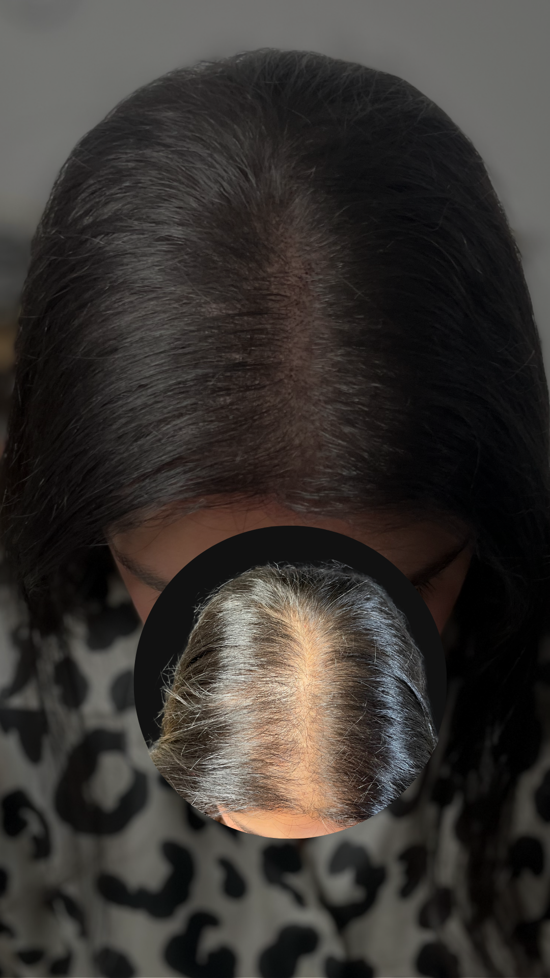 Beige Minimalist Skincare Before and After Instagram Post (1080 x 1350 px) (Votre story)