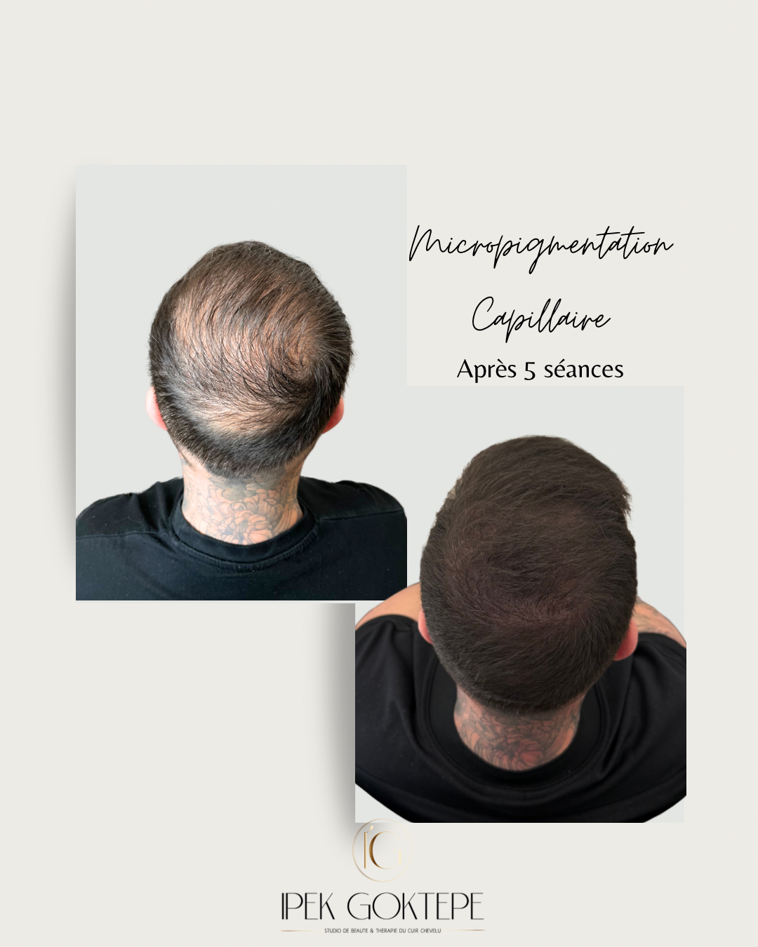 Copie de Beige Minimalist Skincare Before and After Instagram Post (1080 x 1350 px) (Votre story)